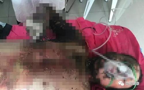如皋医院爆料烧伤视频,惨烈现场令人揪心  第1张